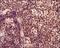 TOR antibody, NBP2-24503, Novus Biologicals, Immunohistochemistry paraffin image 
