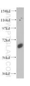 Synaptotagmin 1 antibody, 14511-1-AP, Proteintech Group, Western Blot image 