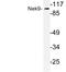 NIMA Related Kinase 9 antibody, LS-C176680, Lifespan Biosciences, Western Blot image 