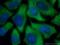 Eukaryotic Translation Initiation Factor 2A antibody, 66482-1-Ig, Proteintech Group, Immunofluorescence image 