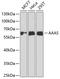 Aladin WD Repeat Nucleoporin antibody, GTX30014, GeneTex, Western Blot image 