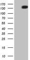 Platelet Derived Growth Factor Receptor Alpha antibody, LS-C340356, Lifespan Biosciences, Western Blot image 