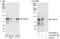 Coiled-Coil Domain Containing 8 antibody, A302-989A, Bethyl Labs, Immunoprecipitation image 