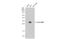 HLA class II histocompatibility antigen, DRB1-15 beta chain antibody, GTX104919, GeneTex, Western Blot image 