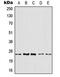 ADP Ribosylation Factor 4 antibody, LS-C353895, Lifespan Biosciences, Western Blot image 