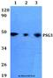 Pregnancy Specific Beta-1-Glycoprotein 3 antibody, A13535, Boster Biological Technology, Western Blot image 