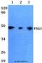 Pregnancy Specific Beta-1-Glycoprotein 3 antibody, A13535, Boster Biological Technology, Western Blot image 