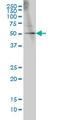 GA Binding Protein Transcription Factor Subunit Alpha antibody, LS-C133212, Lifespan Biosciences, Western Blot image 