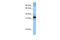 Serine And Arginine Rich Splicing Factor 8 antibody, 25-663, ProSci, Enzyme Linked Immunosorbent Assay image 