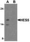 Hes Family BHLH Transcription Factor 5 antibody, A05384, Boster Biological Technology, Western Blot image 