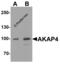 AKAP4 antibody, 7961, ProSci Inc, Western Blot image 