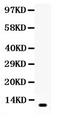 Resistin antibody, LS-C357599, Lifespan Biosciences, Western Blot image 