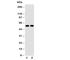 Amylase Alpha 1C (Salivary) antibody, R30559, NSJ Bioreagents, Western Blot image 