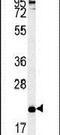 CD319 antibody, PA5-25589, Invitrogen Antibodies, Western Blot image 