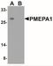 Transmembrane prostate androgen-induced protein antibody, NBP2-41321, Novus Biologicals, Western Blot image 