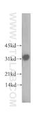 ELMO Domain Containing 2 antibody, 13027-1-AP, Proteintech Group, Western Blot image 