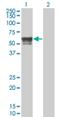 Iroquois Homeobox 6 antibody, H00079190-M01, Novus Biologicals, Western Blot image 