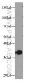 Heterogeneous Nuclear Ribonucleoprotein A1 antibody, 11176-1-AP, Proteintech Group, Western Blot image 