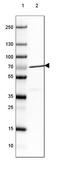 Nuclear pore complex protein Nup85 antibody, NBP2-31860, Novus Biologicals, Western Blot image 