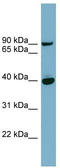 Patatin Like Phospholipase Domain Containing 8 antibody, TA345108, Origene, Western Blot image 