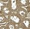 Autophagy Related 4D Cysteine Peptidase antibody, A09793, Boster Biological Technology, Immunohistochemistry paraffin image 