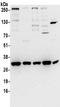VAMP Associated Protein A antibody, NBP2-32249, Novus Biologicals, Western Blot image 