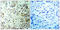 Cyclin Dependent Kinase 1 antibody, LS-C198773, Lifespan Biosciences, Immunohistochemistry paraffin image 