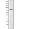 Sodium Channel Epithelial 1 Alpha Subunit antibody, abx218462, Abbexa, Western Blot image 