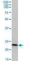 Recoverin antibody, LS-C139407, Lifespan Biosciences, Western Blot image 