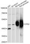 Carboxypeptidase A2 antibody, LS-C749381, Lifespan Biosciences, Western Blot image 