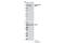 Caspase Recruitment Domain Family Member 11 antibody, 5189S, Cell Signaling Technology, Western Blot image 