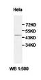 Zinc Finger And BTB Domain Containing 6 antibody, orb77683, Biorbyt, Western Blot image 