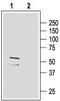 Gamma-Aminobutyric Acid Type A Receptor Gamma2 Subunit antibody, TA328812, Origene, Western Blot image 