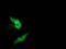 Metabolism Of Cobalamin Associated B antibody, M06106-1, Boster Biological Technology, Immunofluorescence image 