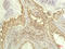Ribosomal Protein S6 Kinase B1 antibody, STJ97708, St John