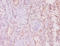 Mucin 16, Cell Surface Associated antibody, A54125-100, Epigentek, Immunohistochemistry paraffin image 