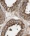 FAS-associated factor 2 antibody, FNab02947, FineTest, Immunohistochemistry paraffin image 