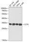 Clathrin light chain A antibody, GTX33101, GeneTex, Western Blot image 