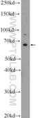 Interleukin 1 Receptor Like 2 antibody, 25677-1-AP, Proteintech Group, Western Blot image 