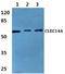 C-Type Lectin Domain Containing 14A antibody, A12642, Boster Biological Technology, Western Blot image 