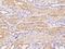 Elongator Acetyltransferase Complex Subunit 6 antibody, 205055-T08, Sino Biological, Immunohistochemistry frozen image 