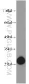 Glutathione S-Transferase Kappa 1 antibody, 14535-1-AP, Proteintech Group, Western Blot image 