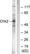 Checkpoint Kinase 2 antibody, LS-C117596, Lifespan Biosciences, Western Blot image 