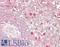 Tax1 Binding Protein 1 antibody, LS-B14187, Lifespan Biosciences, Immunohistochemistry paraffin image 