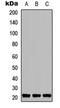 TNF Alpha Induced Protein 8 Like 1 antibody, orb234971, Biorbyt, Western Blot image 