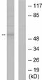 Matrix Metallopeptidase 8 antibody, ab53017, Abcam, Western Blot image 