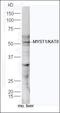 Lysine Acetyltransferase 8 antibody, orb157725, Biorbyt, Western Blot image 