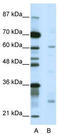 Nuclear Receptor Subfamily 1 Group I Member 2 antibody, TA345353, Origene, Western Blot image 