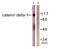 Catenin Delta 1 antibody, LS-C198740, Lifespan Biosciences, Western Blot image 