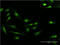 S100 Calcium Binding Protein P antibody, LS-C198146, Lifespan Biosciences, Immunofluorescence image 